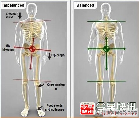 如何避免骨盆歪斜？骨盆歪斜怎么预防？